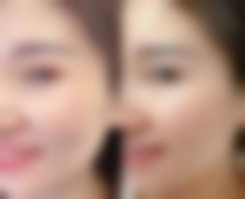 四、南昌针美荟整形医院特色项目