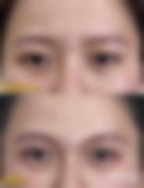 三、西安先雁塔柏凯医疗美容医院诊疗项目有哪些？