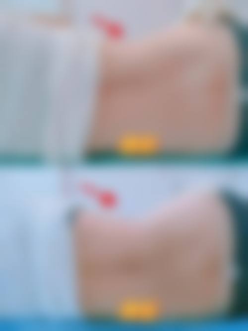 二、南昌美诺医疗美容门诊部怎么样？