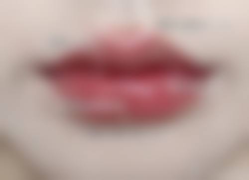 三、菏泽丽雅医疗美容门诊部诊疗项目有哪些？