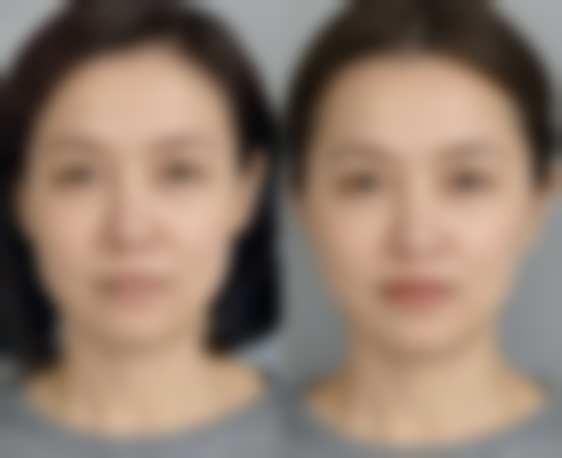 八、南昌针美荟整形医院真实的患者评价