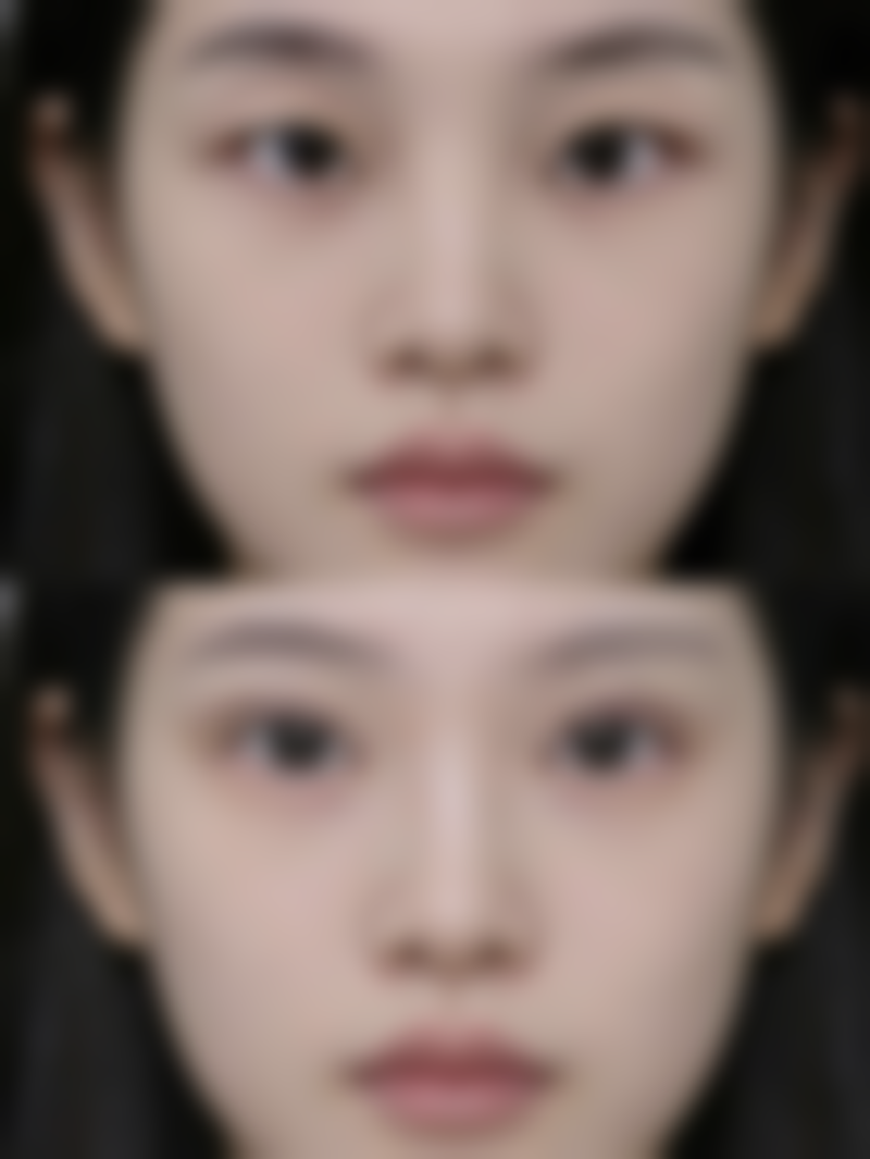 九、西安先雁塔柏凯医疗美容医院真实的患者评价