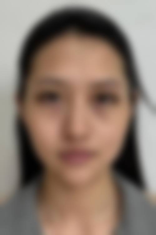 四、成都天美整形医院特色项目