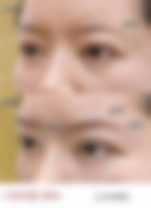 八、广西 南宁英和医疗美容门诊真实的患者评价