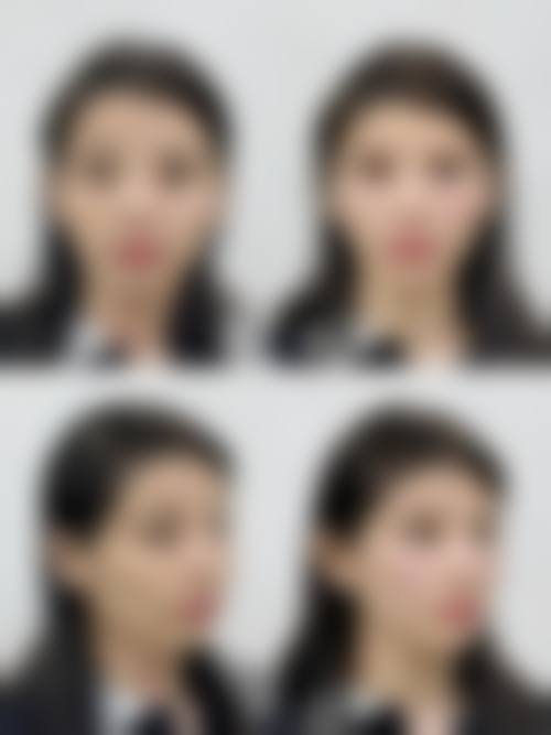 四、广西 南宁英和医疗美容门诊特色项目