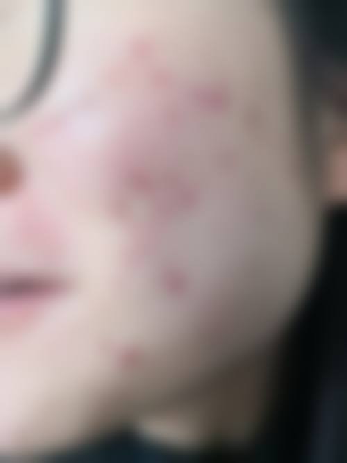 六、莫利香真实的患者评价