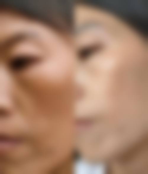 四、郑州倪红医疗美容诊所特色项目