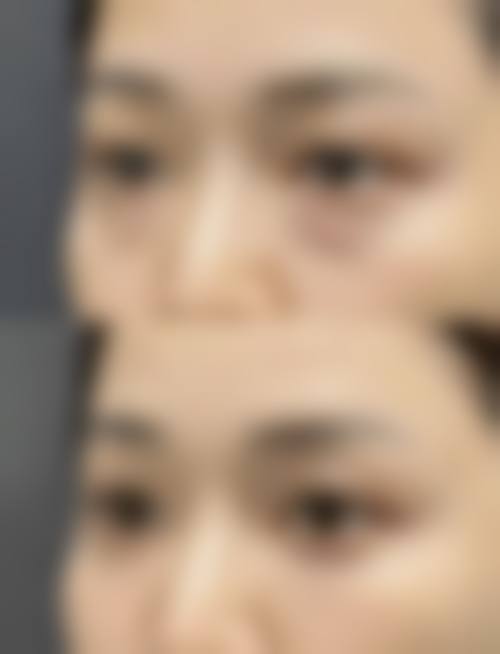 五、山东威海环翠区董立鹏医疗美容诊所价格表