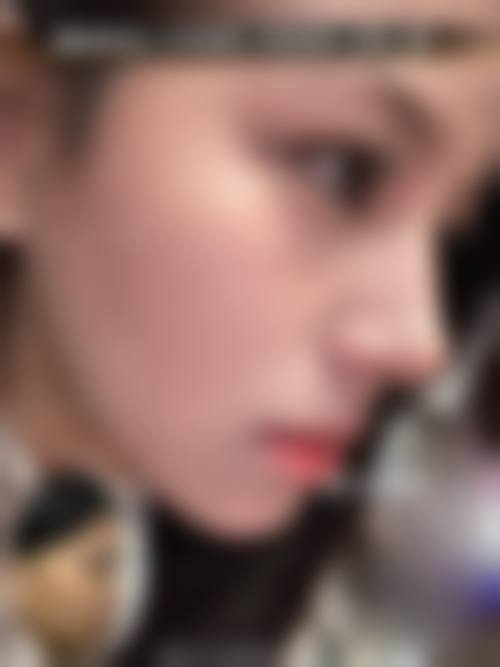 八、郑州倪红医疗美容诊所真实的患者评价