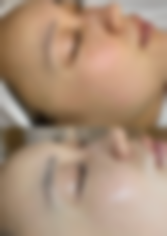 一、男士眼袋皱纹产生的原因