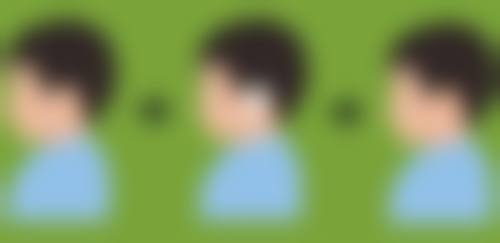 二、割双眼皮后换身份证的常见难题