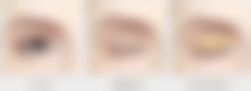 一、割双眼皮后换身份证的必要性