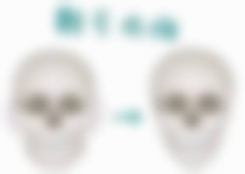 女人眼袋是什么原因？遗传、睡眠、老化、过敏、疾病等因素或是“元凶”