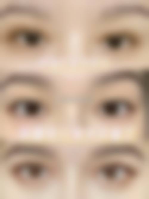 四、深圳贝加美医疗美容门诊部特色项目