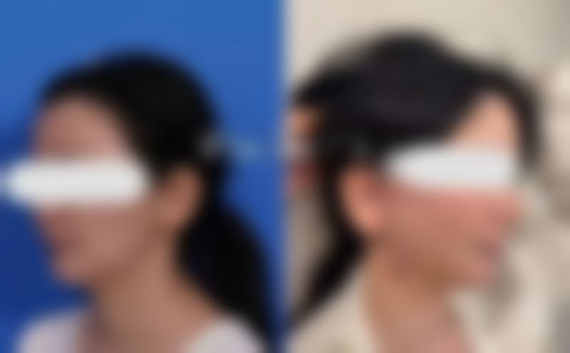 九、深圳贝加美医疗美容门诊部真实的患者评价