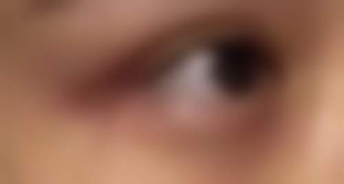 做双眼皮哪种最安全？埋线、韩式三点、全切大对比，为你选出最佳方式 