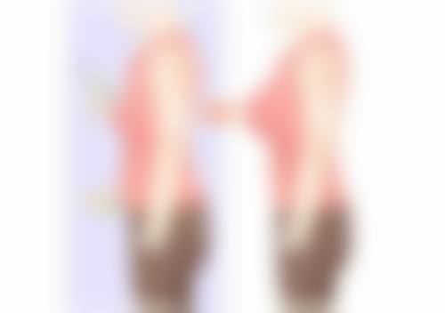 一、做双眼皮哪种更安心之埋线双眼皮