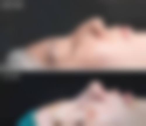 四、北京伊桐美润医疗美诊所特色项目