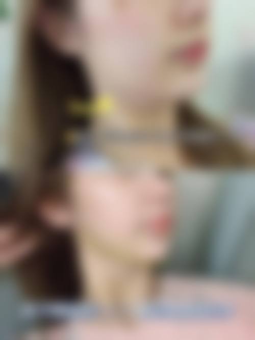 四、湘潭顾维新医疗美容科诊所特色项目