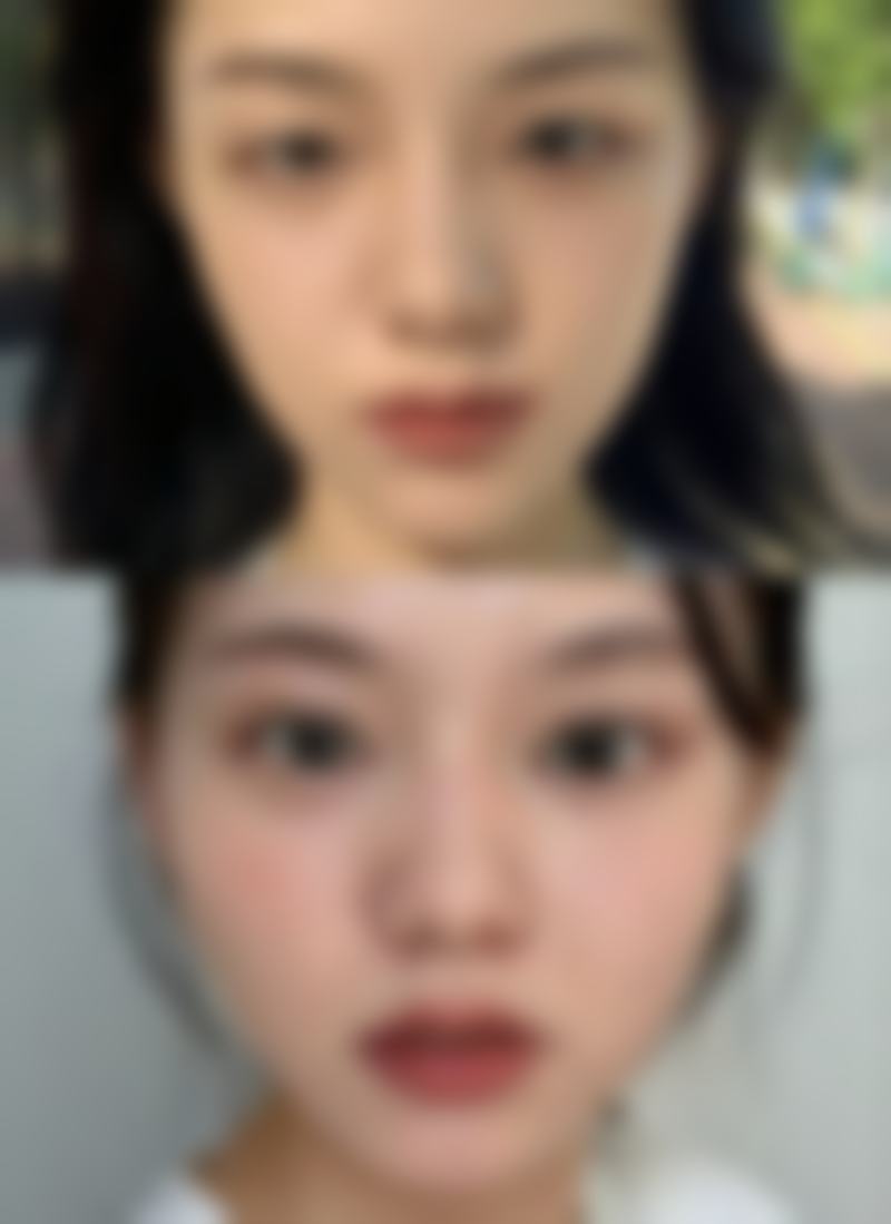 九、延世uline牙科江南店真实的患者评价