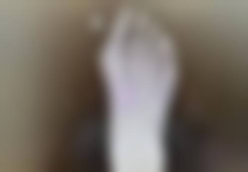 怎么样去眼袋有效果吗？多种方法揭秘+真实图片展示助你告别眼袋烦恼