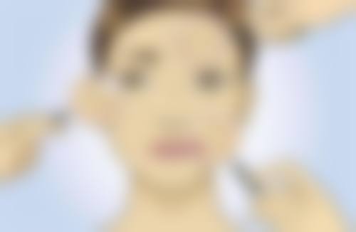 注射除皱有哪些副作用和危害？了解这些才能安全变美！ 