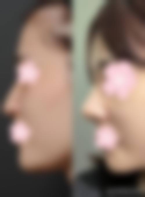 七、深圳仟颜整形医院预约方式