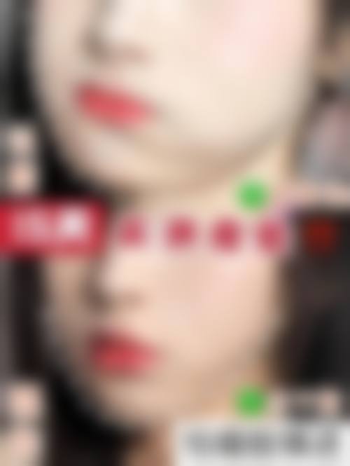 五、深圳仟颜整形医院价格表