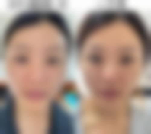 三、深圳仟颜整形医院诊疗项目有哪些？