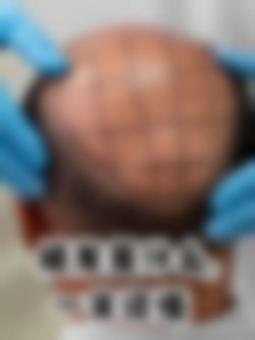 五、朱世伟怎么预约？