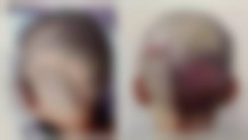 八、宁夏长生医院医学美容科真实的患者评价