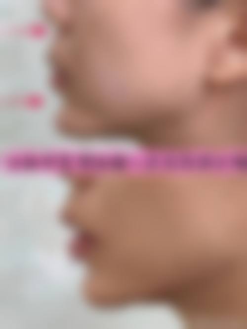 四、深圳仟颜整形医院特色项目