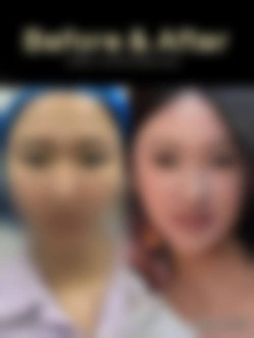 二、韩国美特乐整形医院怎么样？