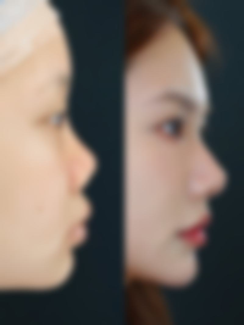 六、韩国美特乐整形医院价格表