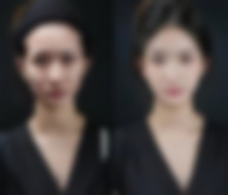 三、韩国美特乐整形医院诊疗项目有哪些？