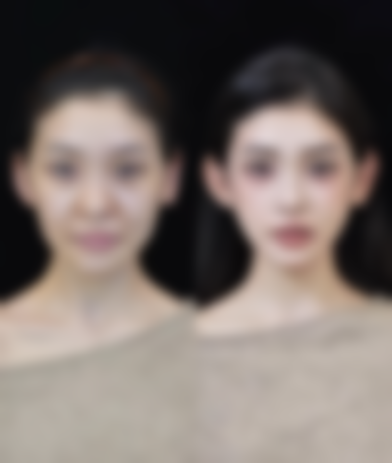 五、注射除皱有哪些副作用和危害？总结与提醒