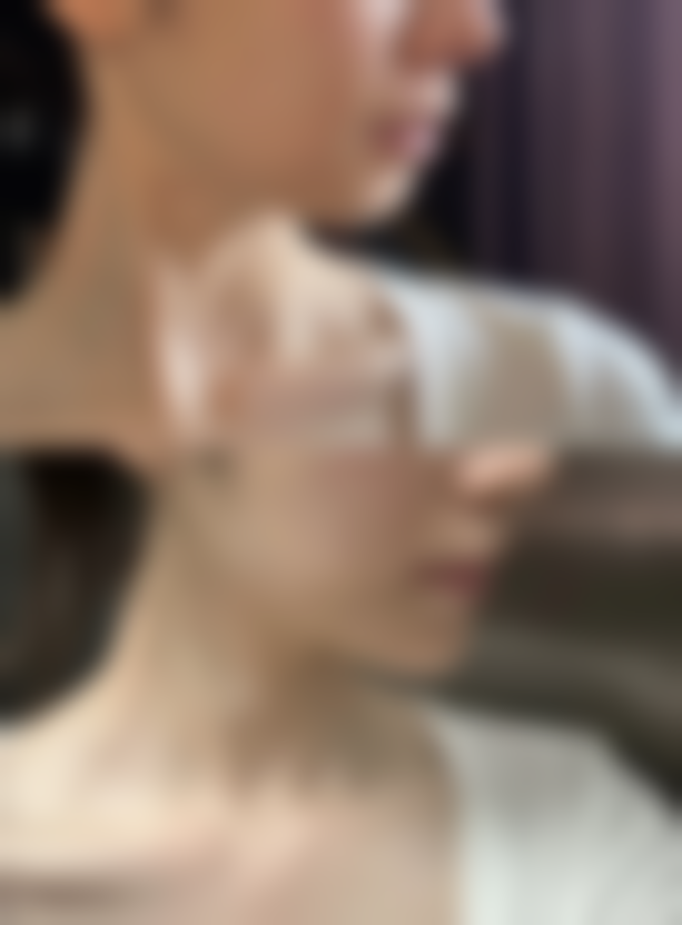 深蓝射频除皱有效果吗？揭秘其神奇功效与合理价格区间