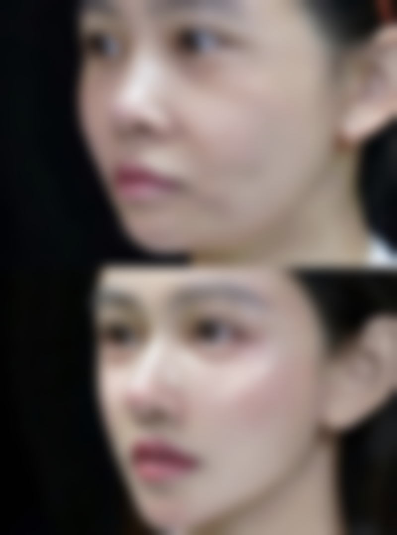 一、怎么样去眼袋有成效之调整作息