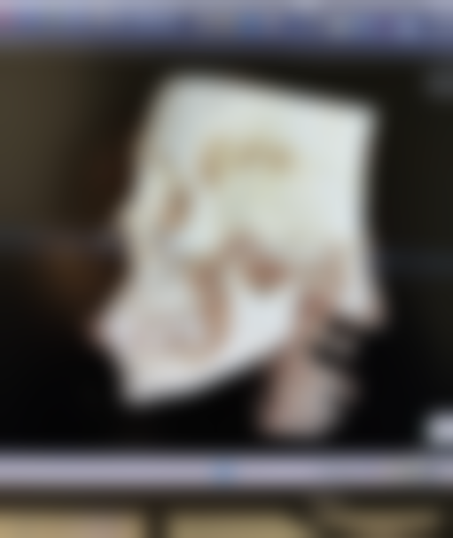 二、50岁的人眼袋好大又黑，改善生活方式特别重要