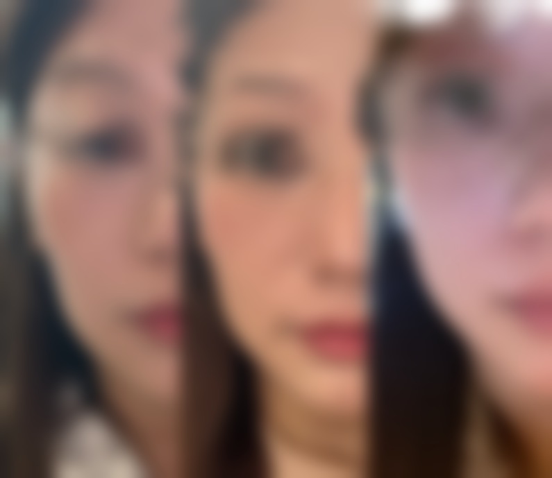 四、西安科医颜整形医院特色项目