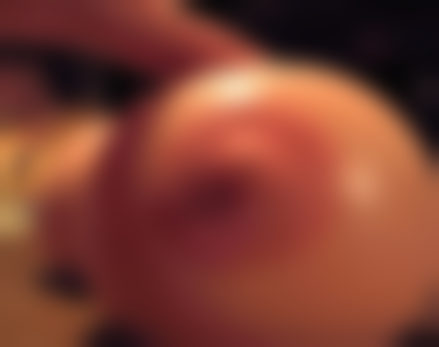 一、做完点阵激光疤痕修复后早期适用药膏