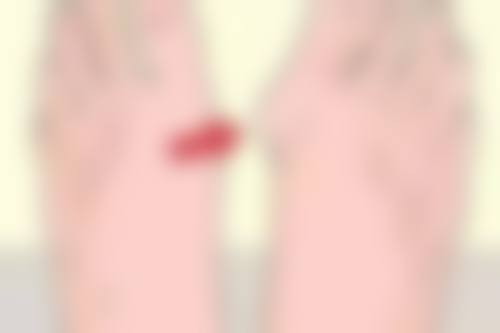 四、去除嘴上疤痕的注意事项