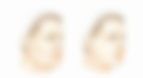 一、头发种植费用的大致范围