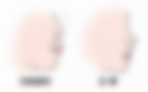 五、去增生疤痕的日常护理和注意事项