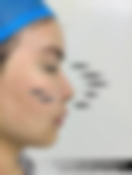 八、韩国李周赫KIESU整形外科医院预约方式