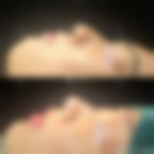 八、成都锦江温妮莎医疗美容门诊部真实的患者评价