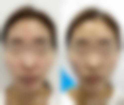 六、东莞缔美整形美容医院价格表