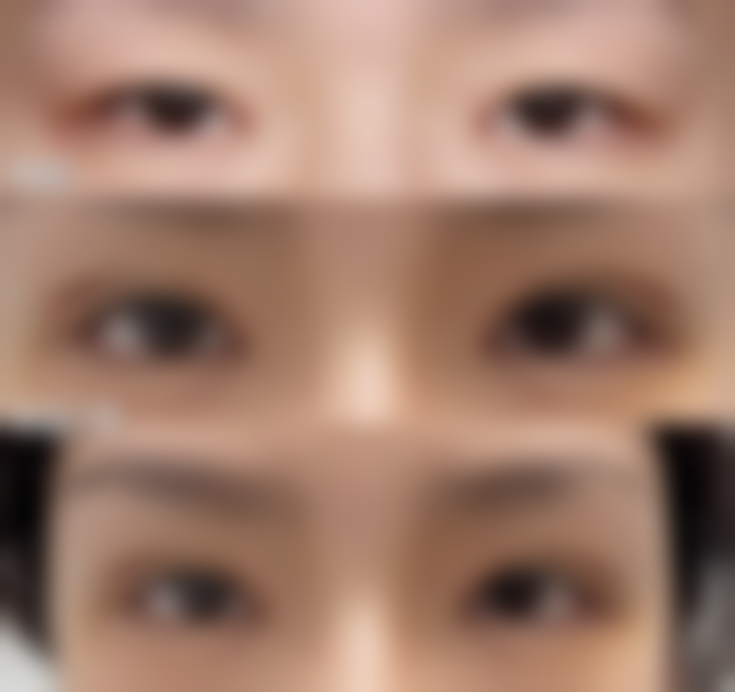 四、涂抹药膏的注意事项