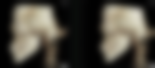 四、科学应对眼袋问题