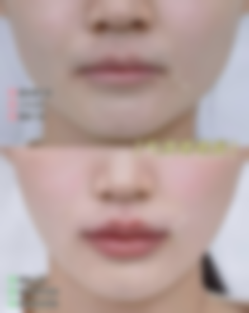 五、天津南开悦美整形医疗美容价格表